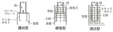 露出型、根巻型、埋込型